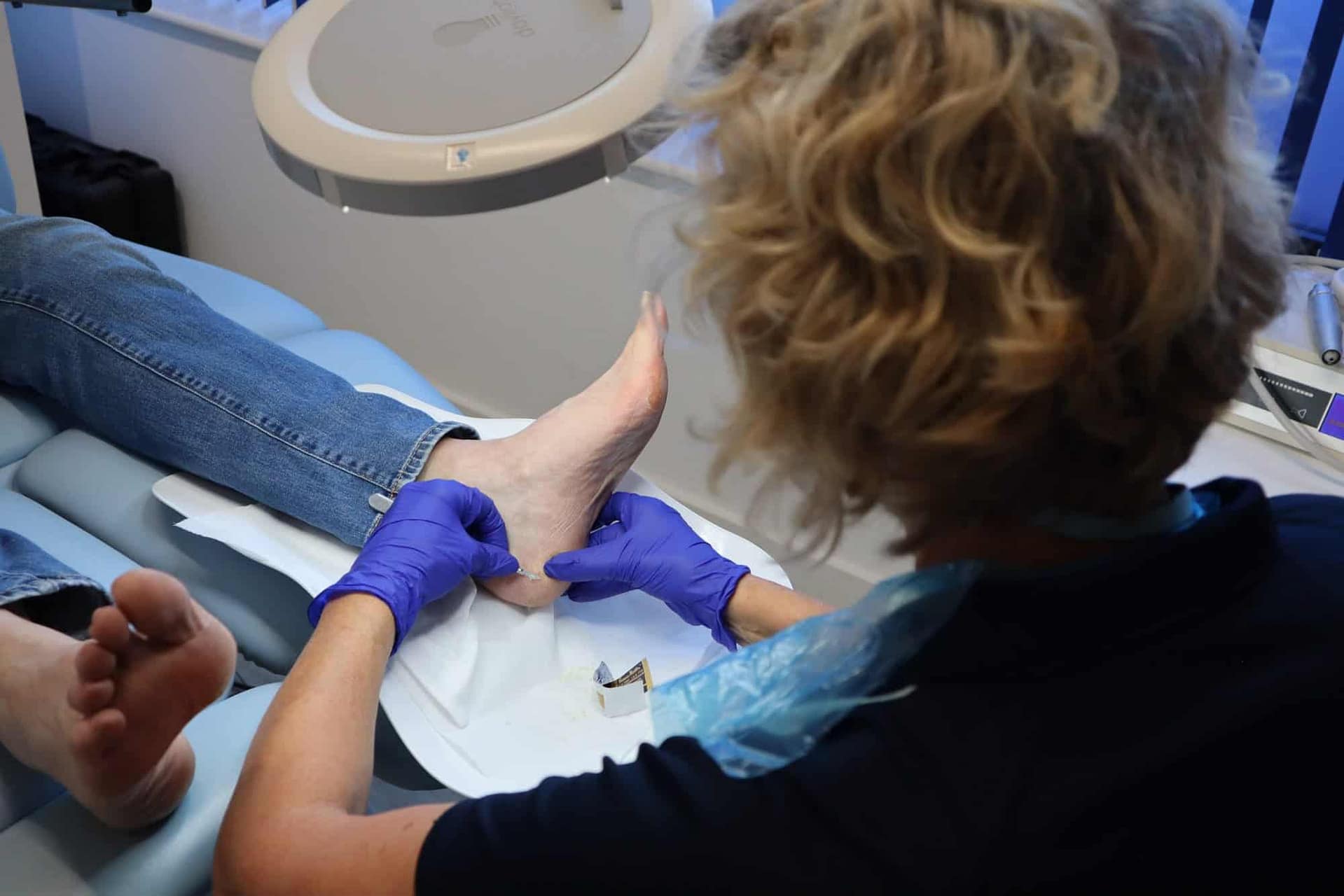 removal heel callus